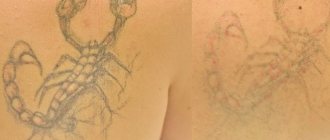 Combien de sessions avez-vous besoin ?