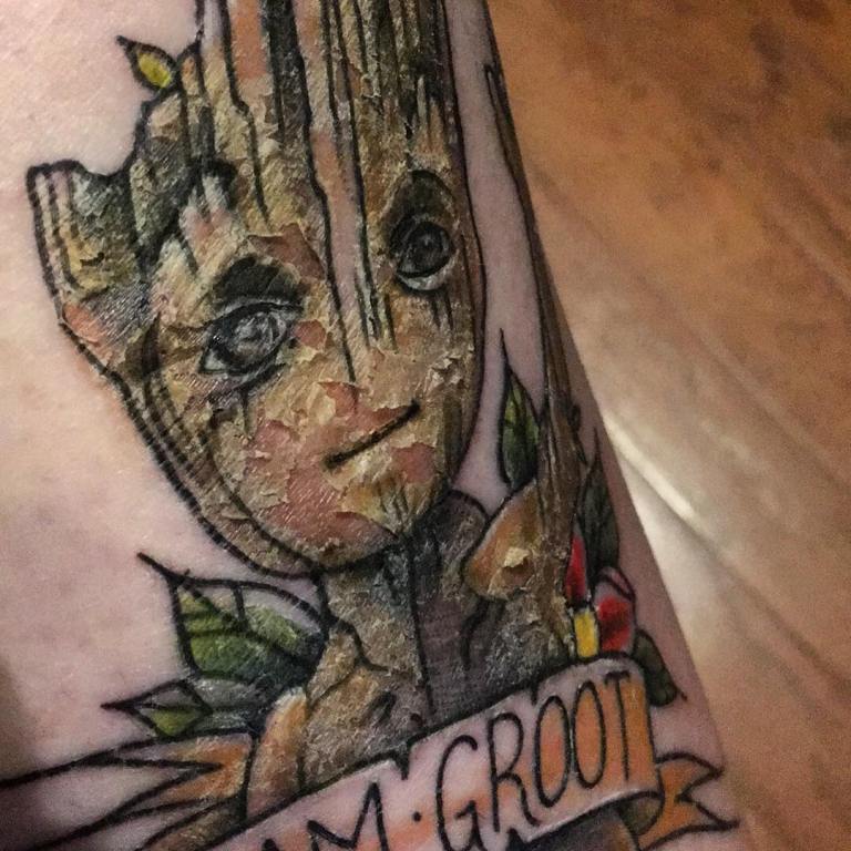 ¿Cuánto tiempo dura la curación?