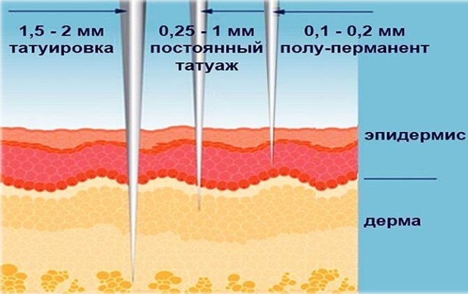 Devrais-je me faire tatouer ? Avantages et inconvénients