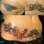 Tattoo to hide C-section stitches on abdomen