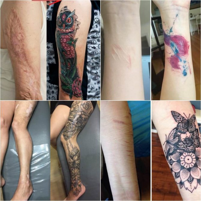 Tatuajes de cicatrices - Tatuajes de cicatrices - Tatuajes de cicatrices