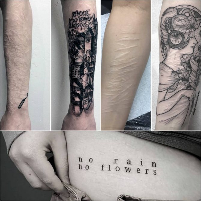 Tetování na jizvy - Tetování na jizvy - Tetování na jizvy - Krytí na jizvu