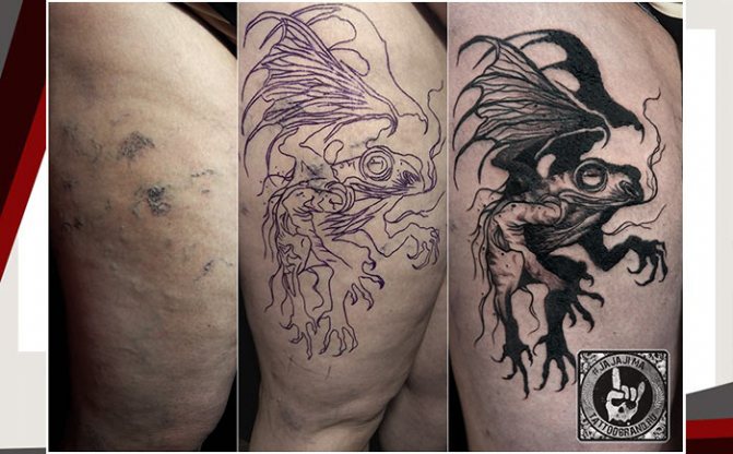 Татуиране на припокриващи се несъвършенства на кожата