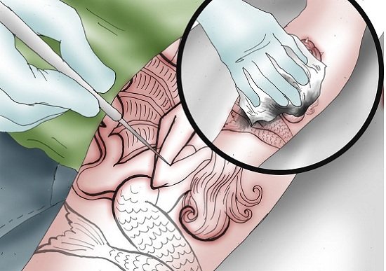 Stick n pokes tatuaggio permanente