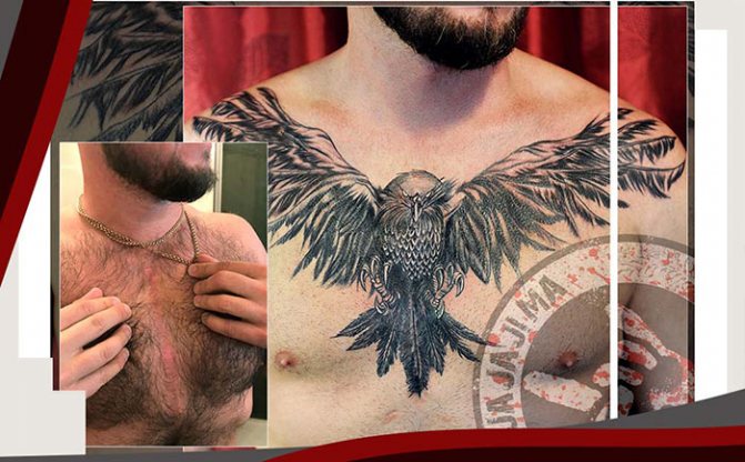 татуировка върху белези