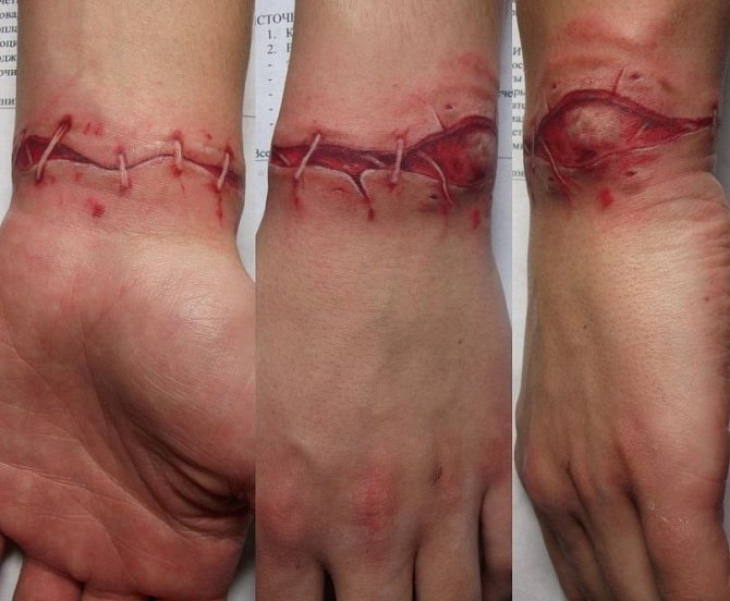 Tatouage de cicatrice