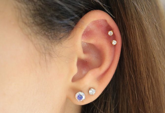 Tecnologia della procedura