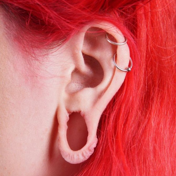 tunnels in the ears consequences