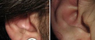 Túneles en los oídos de las niñas. Fotografías, tamaño de las estrías, cuidados