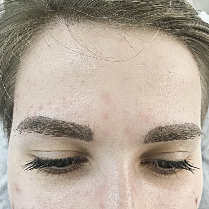 Élimination du pigment PermaBlend