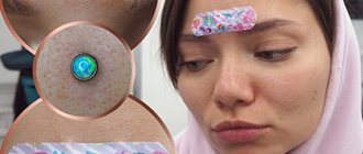 Φροντίδα σκουλαρικιού