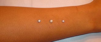 käsivarren koristeet