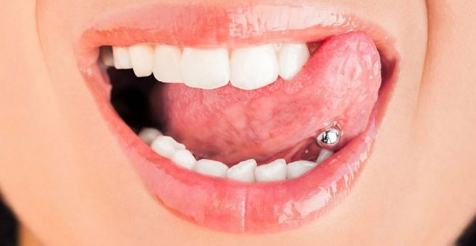 Il est important de suivre toutes les recommandations après l'intervention, afin d'éviter les complications.