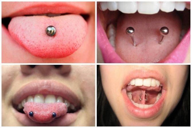 Κάθετη διάτρηση