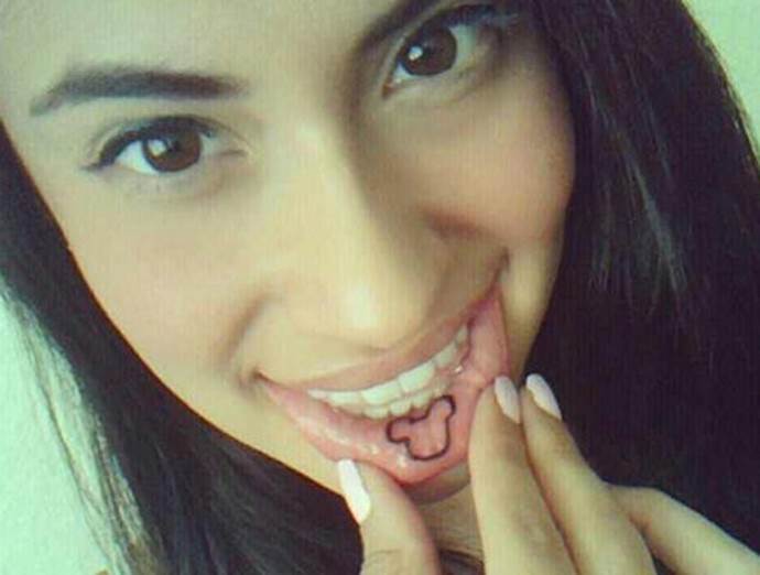 パーカーブルネット