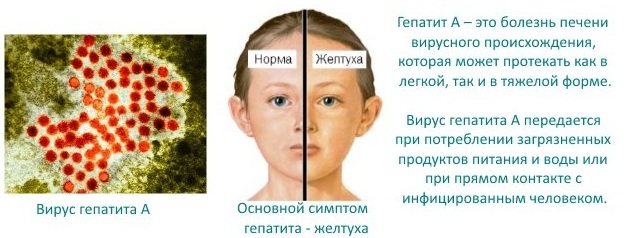 Gelbe Wolfsaugen bei einem Mann. Natürliches Foto, Ursachen