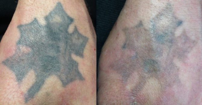 Solución de manganeso