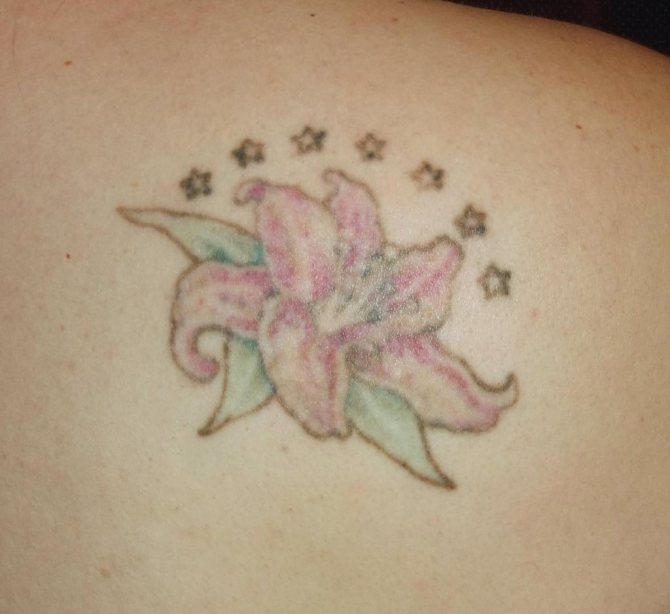 Tattoo fjernelse plante