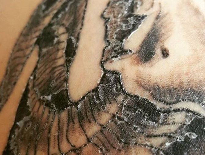 curación de tatuajes